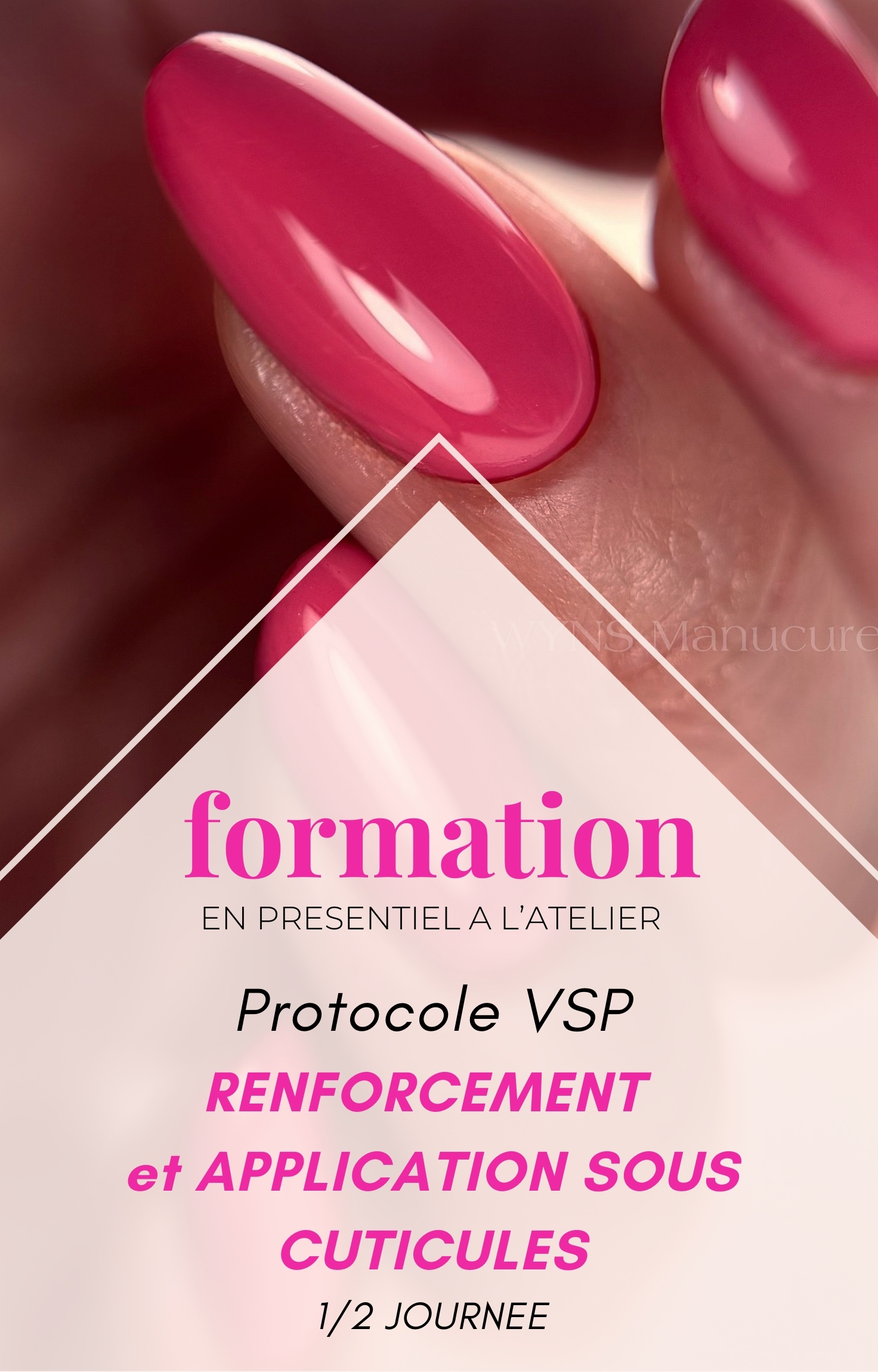 Module Renforcement VSP & Sous Cuticules